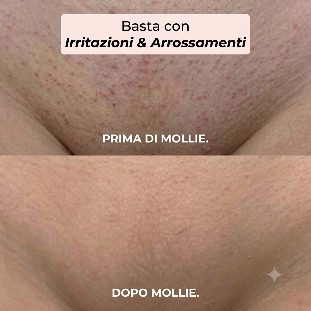 Rasoio 2 in 1 per bikini e corpo Mollie™