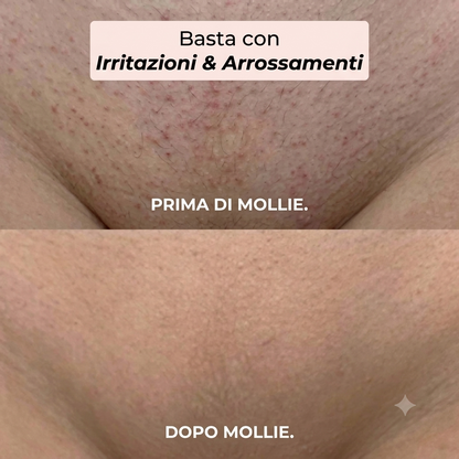 Rasoio 2 in 1 per bikini e corpo Mollie™